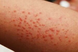 WhatsApp Image 2026-01-19 at 11.26.58