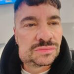 Shiky es hospitalizado de emergencia por segunda ocasión para una cirugía